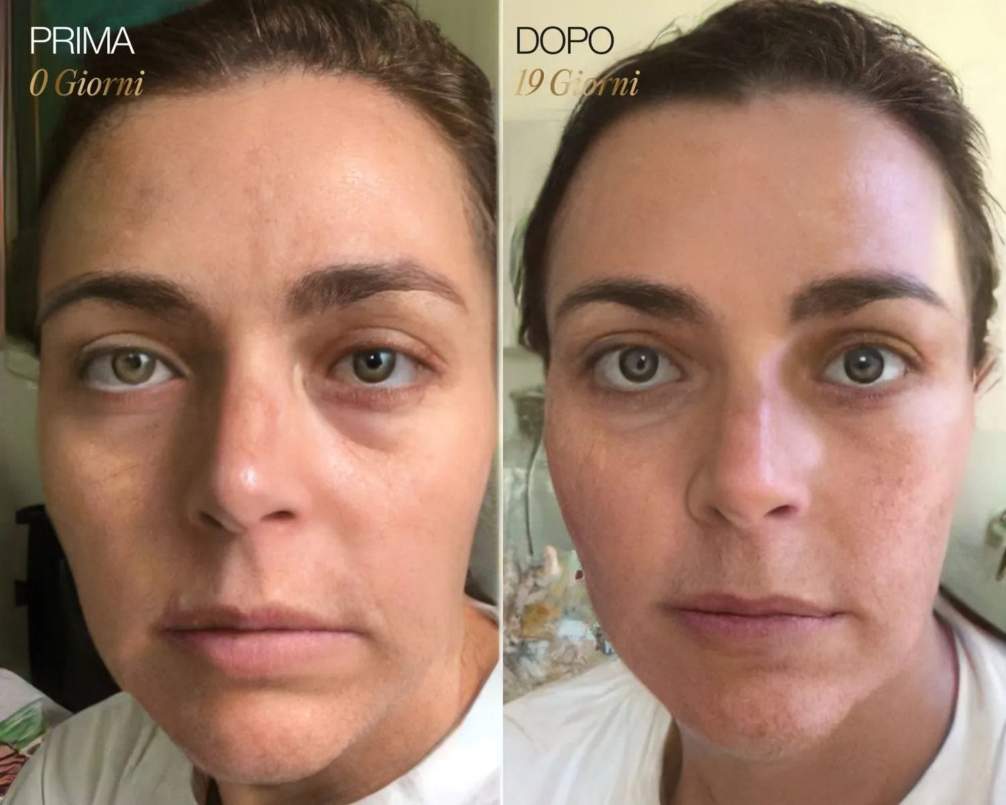 Ritual Cepillo Linfático Facial Diario