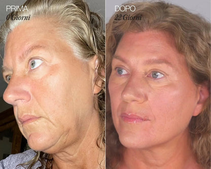 Ritual Cepillo Linfático Facial Diario